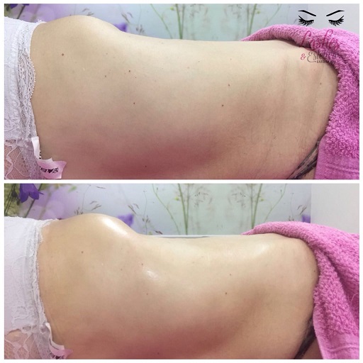 lashes